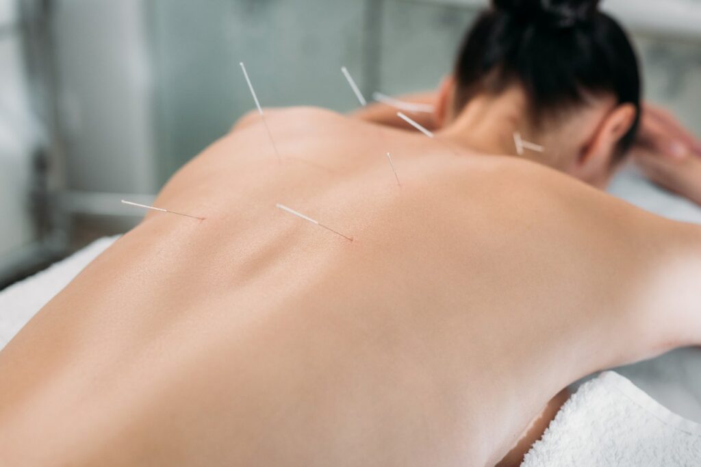 Woman with needles on her back