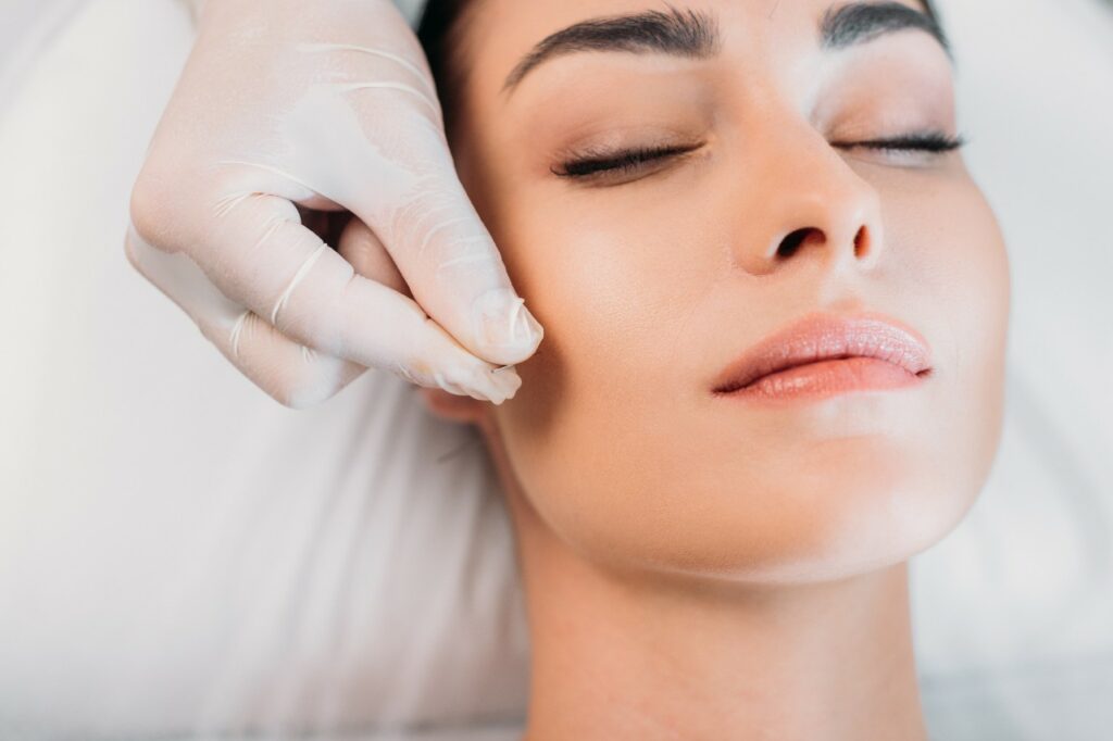 Burnaby Facial acupuncture on woman