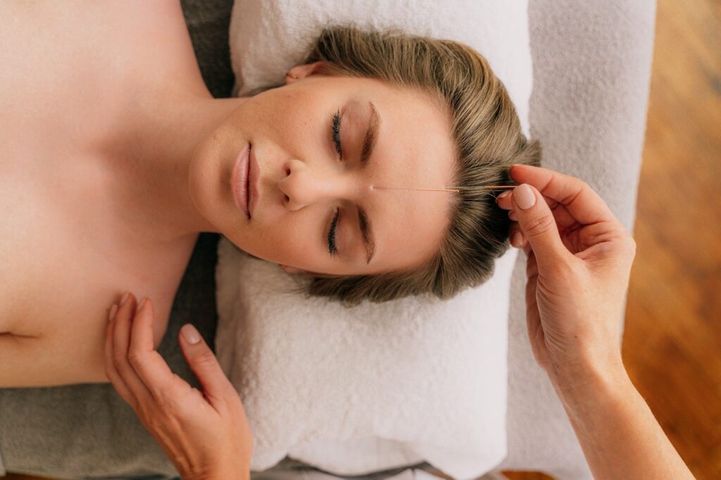 Woman Receiving a Facial Acupuncture Treatment in Burnaby