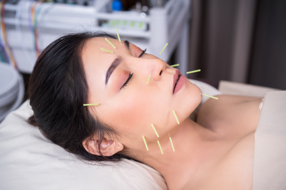 Can Acupuncture Make Your Face Look Younger? aging process, chronic or recurring pain