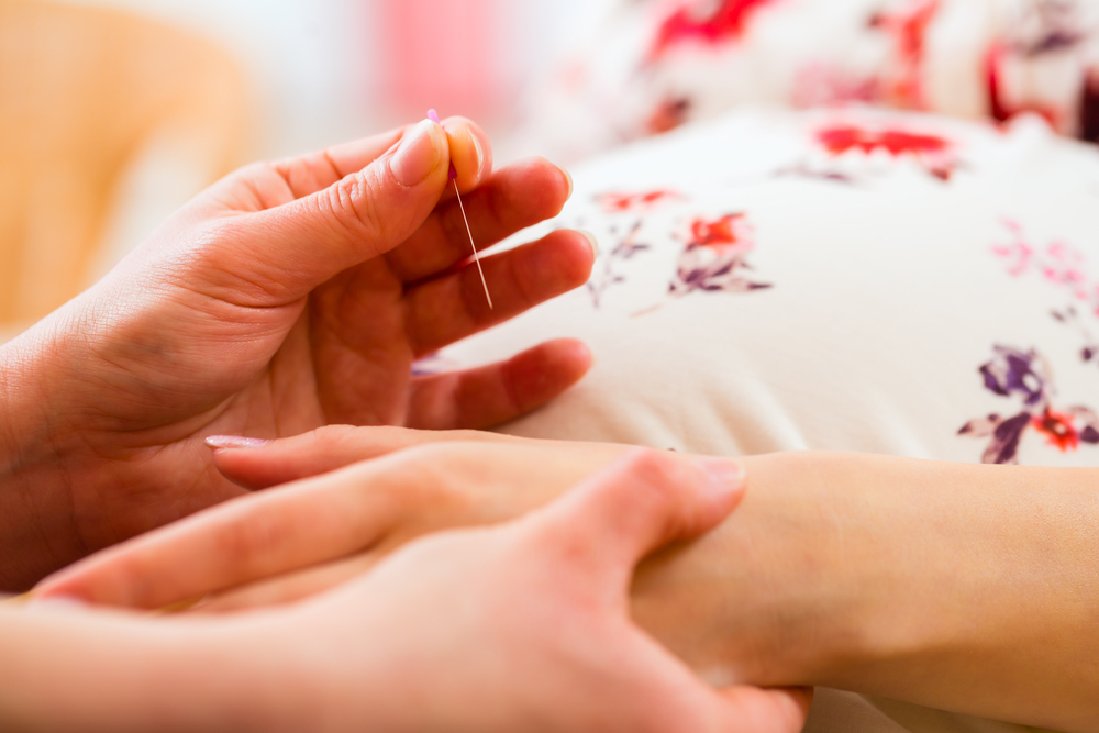 A woman receiving acupuncture treatment for ovarian follicles blood stasis
